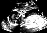 Personalisierbares Ultraschallbild als Scherzartikel – mit Name, Datum, SSW – Baby Andenken oder Geschenk Scherz (GA 20w)