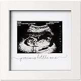 Baby Bilderrahmen für Ultraschallbild – Bilderrahmen Ultraschallbild Baby - Bilderrahmen Schwangerschaft für Werdende Mama - Baby Ultraschall Bilderrahmen - Ultraschallbilder Rahmen (Alpine White)