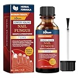 Nagelpilz Nagellack, Nagellack gegen Nagelpilz für Fingernägel und Fußnägel, Schutz & Stärkung Brüchiger Nägel, Spendet Feuchtigkeit Trockener Nagelhaut, 30ml(pack of 1)