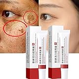 2PCS Whitening Freckle Cream,Scar Removal Treatment...
