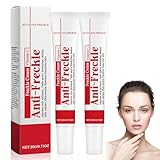 Altersflecken Creme Gegen Dunkle Flecken - 2 Stück Pigmentflecken Entferner Gesicht - Anti Aging Skin Lightening Cream - Anti Pigmentflecken Gesicht mit Vitamin C - Anti Freckle Cream Damen
