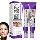 2 Stück Ceoerty EPIGLOW MelanEX Advanced Anti-Hyperpigmentation Cream, Anti-Pigmentflecken Creme, Pigmentflecken Entferner Gesicht, Dark Spot Cream gegen Melasma, Altersflecken & Pigmentflecken