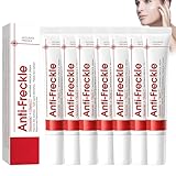 7 Stück Creme Gegen Pigmentflecken, Melasma Cream,Aufhellungscreme für Sommersprossen Hellt Den Hautton Auf für Einen Ebenmäßigen Strahlenden Hautton